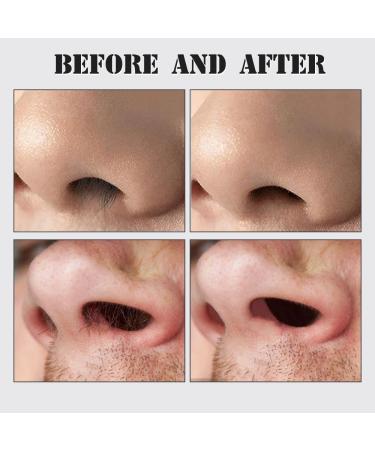 CBPNEISEK 2 in 1 Nose Hair Trimmer Mini Double Sided Portable Nose Hair Trimmer Manual 360 Rotating Nose Hair Remover for Men and Women 1634 Blue - Buy Online on GoSupps.com