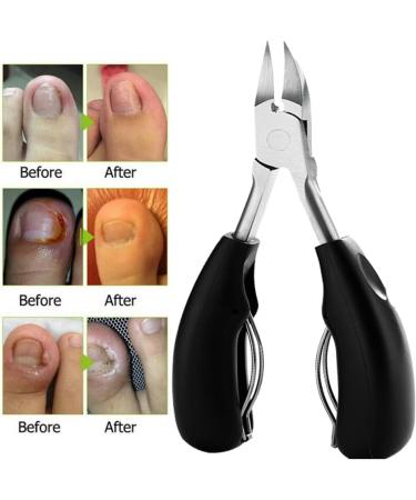 SJLS Toenail Clippers for Thick Ingrown Toe Nails Heavy Duty Precision Nail Scissor (Color : Black) - Buy Online on GoSupps.com