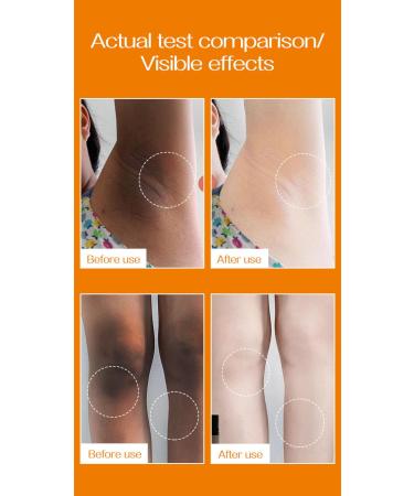Crema Para Las Manchas De La Cara Crema De Arroz Para Blanquear La Piel Cremas Para Las Manchas De La Cara Oscuras 20ml Para Piel Entrepierna Manchas Codos Piernas Zonas Rodillas Cuello (3pcs) - Buy Online on GoSupps.com