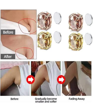 Kyana Lympha-circurl Magnetic Ear Ornament Metiz Lymphvity Magnetherapy Earrings Non Piercing Acupressure Magnetic Earrings Lympha-circurl Magnetic Ear Ornament for Lymphatic Drainage (5Pcs-A) - Buy Online on GoSupps.com