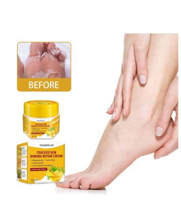 Toenail Treatment Cream & Foot Cream for Cracked Heels - Deep Moisturizing & Daily Care (1g Pack) - Buy Online on GoSupps.com
