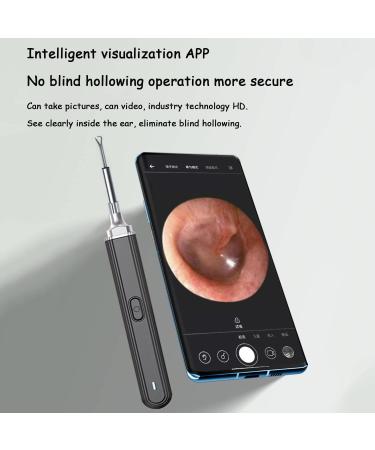 Sberna Smart Earwax Removal Kit - 3.0mm Otoscope for Kids and Adults - 6 LED Lights - White - Buy Online on GoSupps.com