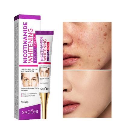 Dark Spot Remover for Face Nicotinamide Whitening Freckle Cream Skin Dullness Lightening Body Cream Visible Results in 28 Days Smooth Melasma Hyperpigmentation Age Dark Spot Corrector 0.7 oz