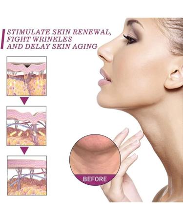 NECKPON Hydrolized Collagen Neck Cream Hydrolized Collagen Neck Cream Neck Firming Cream Hydrolyzed Collagen for Delay Skin Ageing Smooth & Youthful Skin 1pcs - Buy Online on GoSupps.com
