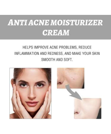 Anti-Acne Cream for Women - Face Cream for Acne Prone Skin - Oily Skin Moisturiser - Acne Control Facial Cream with Hyaluronic Acid and Niacinamide - Acne Remover Cream for Moisturizing Hydrating - Buy Online on GoSupps.com
