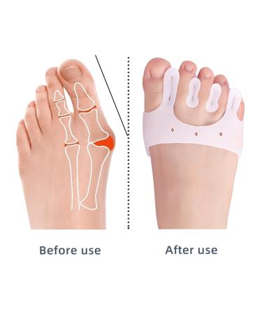 Jhtsole Toe Separator & Spacers - Cushioned Toe Slippers for Bale & Hammer Toes - 2 Pairs (White + Beige) | Comfort & Forefoot Support - Buy Online on GoSupps.com