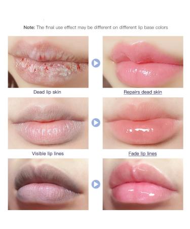 Buy Lip Repair Gel - Moisturizing Lip Balm for Soft Soothed Lips | International Shipping Available - Buy Online on GoSupps.com