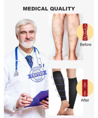 Medical Compression Stockings 20-30 mmHg for Men & Women | 2 Pairs Calf Support for Varicose Veins & Edema | Flight & Sport | 3XL Black & Beige - Buy Online on GoSupps.com