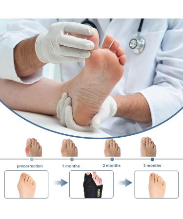 ZJchao Adjustable Bunion Corrector Brace - Pain Relief & Support for Men and Women | Elastic Breathable with Aluminum Strengthening Bars - Buy Online on GoSupps.com