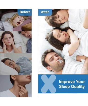 Sleep Strips 90 Pcs | Gentle Mouth Tape for Better Nose Breathing, Improved Nighttime Sleeping, Instant Snoring Relief - Buy Online on GoSupps.com