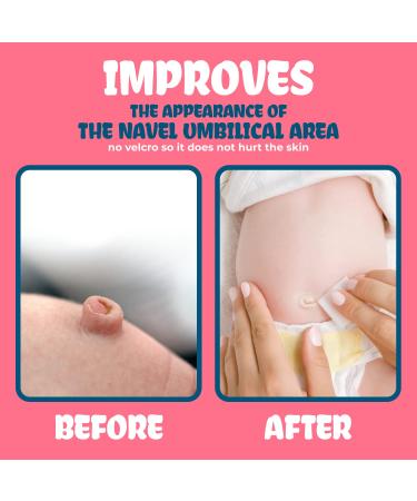 Baby Belly Button Shaper Plug | Umbilical Hernia Belt | Baby Stomach Band - Newborn Care Essentials - Buy Online on GoSupps.com