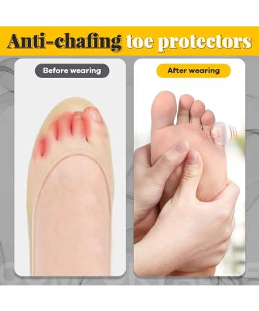 2023 New Silicone Anti-Friction Toe Protectors - Breathable Clear Covers (10Pcs) - Buy Online on GoSupps.com
