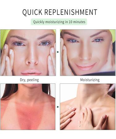 Tongyend Aloe Gel After Sun Moisturizing Lotion Acne Removing Soothing Natural Vegan Cruelty-Free All Skin Types Aloe Vera Gel Moisturizing Capsule 50ml For Body Skin Care - Buy Online on GoSupps.com