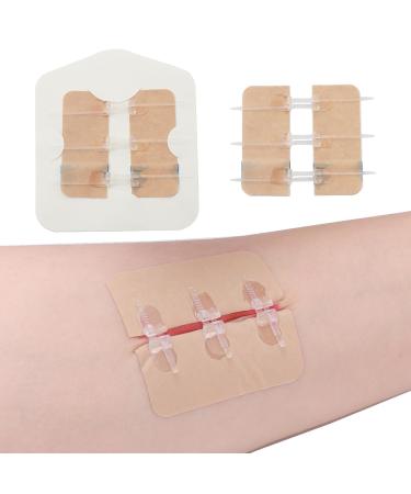 Emergency Waterproof Wound Closure Strips Butterfly Bandages Stitch Sutures Adhesive Bandages for First Aid Zipper Laceration Repair Without Stitches for Wound Care 2 Pieces-2.17*1.97 "