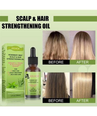 Kesh King Rosemary Mint Strengthening Oil - 59ml | Nourish Hair & Scalp Prevent Hair Fall Suitable for All Hair Types - International Shipping Available - Buy Online on GoSupps.com