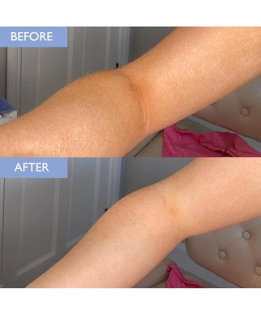Buy Skinician Exfoliating Body Scrub - Effective Gentle Skin Exfoliation for All Skin Types | Free International Shipping - Buy Online on GoSupps.com