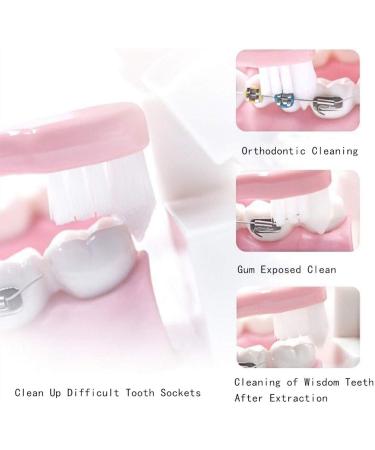 Buy Tepe Toothbrush Set - 4 Interdental Brushes for Braces & Gaps | International Shipping Available - Buy Online on GoSupps.com