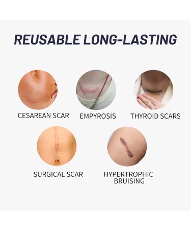 Scar Gel for Face Advanced Scar Remover Anti Scar Cream for Face Silicone Scar Gel Scar Cream Scar Removal Cream for Cesarean Burns and - Buy Online on GoSupps.com