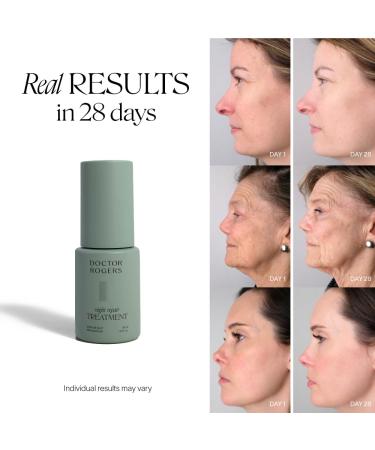 Doctor Rogers Night Repair Treatment | Hydrating Anti-Aging Serum for Men & Women | Glycolic Acid & Bakuchiol | 30ml - Buy Online on GoSupps.com
