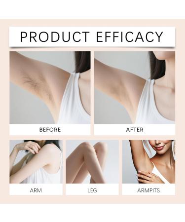  FUYOULILO No-Shave Hair Removal Cream for the Body (Legs Arms and Underarms) (Combination) - Buy Online on GoSupps.com