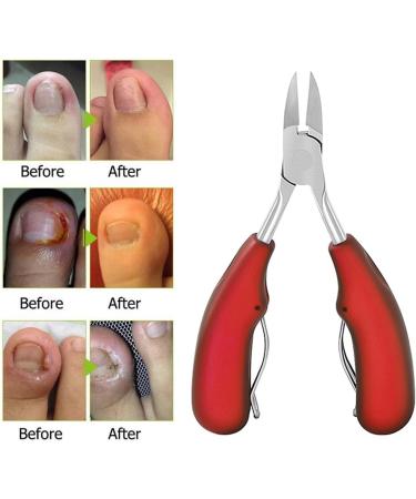 PSGS New 1PC 4Color Stainless Steel Eagle Mouth Toe Nail Clippers Finger Cuticle Nail Correction Dead Skin Dirt Remover Pedicure Tool (Color : Blue) - Buy Online on GoSupps.com