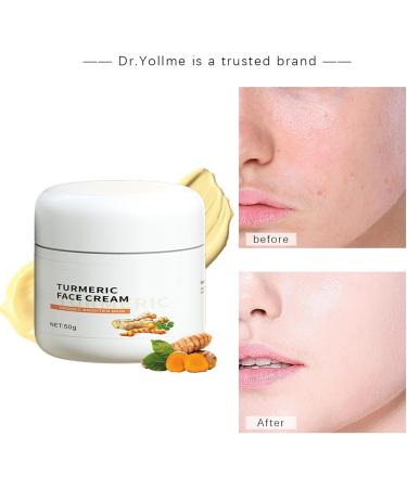 Moisturizing Face Lotion50g Moisturizing Daily Skin Firming Cream for Face Multifunctional Turmeric Dark Spots Corrector Cream Nongreasy Skin Face Cream for Aokley - Buy Online on GoSupps.com