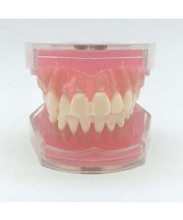 PURFWOG Dental Teeth Model - Disassembled Full Mouth Teeth Crown Model with Soft Gums for Dental School Study & Teaching - Buy Online on GoSupps.com