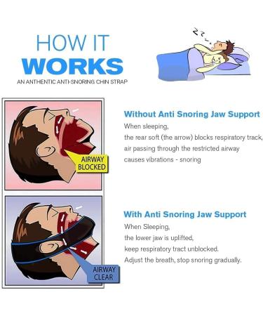 2022 Upgraded CUIZOKUY Anti Snoring Chin Strap - Adjustable Stop Snoring Device for Men and Women - CPAP Compatible - Sleep Aid for Snore Reduction - Buy Online on GoSupps.com