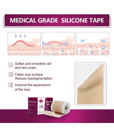 Medical Grade Reusable Silicone Scar Tape - 1.6 x 60 - Comfy & Painless Removal for Keloid, C-Section, Burn & Surgical Scars - Economy Roll - Buy Online on GoSupps.com