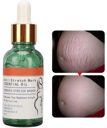 Scar Prevention & Stretch Mark Repair Essential Oil - Premium Beauty Solution for Women | Shop Now! - Buy Online on GoSupps.com