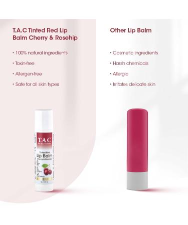 Tinted Cherry & Rosehip Vegan Lip Balm SPF 20 - Soothing Chapped Lips with Vitamin E & Shea Butter | Unisex All Skin Types 5g - Buy Online on GoSupps.com