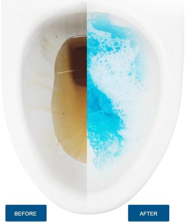 YOXIER Powerful Toilet Bowl Cleaner Effervescent Tablets Cleaning Removes Stains Odors Refreshes Bathroom Hassle-Free Solution 5/10/20 Pcs Mineral Pink 10 pcs - Buy Online on GoSupps.com