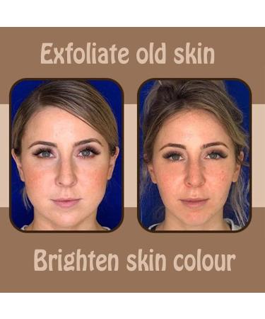 Deep Exfoliating Arabica Coffee Scrub Coffee Body Scrub Moisturizing Exfoliating Dry Dead Skin Body Scrubs for Women Exfoliation - Buy Online on GoSupps.com