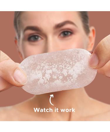 Hydrocolloid Acne Patches with Tea Tree Oil - 138 Patches for Face, Chin, Nose, Body - Salicylic Acid Treatment for Large Zits - Buy Online on GoSupps.com