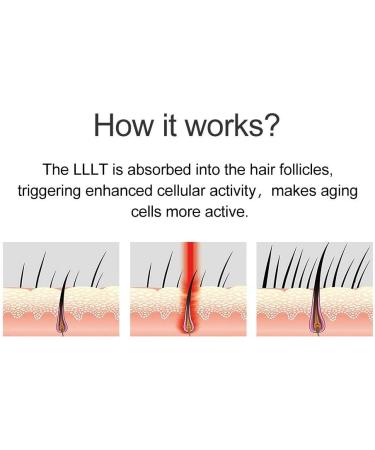 Hair Growth System for Men & Women - FDA-Cleared Hair Loss Treatment for Thinning Hair - Restore Thickness, Volume, and Density - Androgenetic Alopecia Solution - Buy Online on GoSupps.com