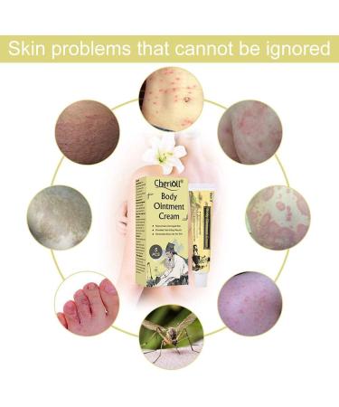 Cherioll Moisturising Cream Uncomfortable Skin 5PCS - Buy Online on GoSupps.com