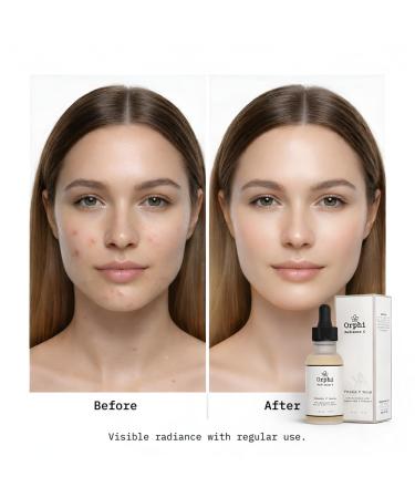 Orphi Radiance C Vitamin C Face Serum Fragrance-Free with Hyaluronic Acid Ferulic Acid & Vitamin E for Bright Glowing Skin Hydrating Skincare Gift for Valentine s Day Made in USA - Buy Online on GoSupps.com