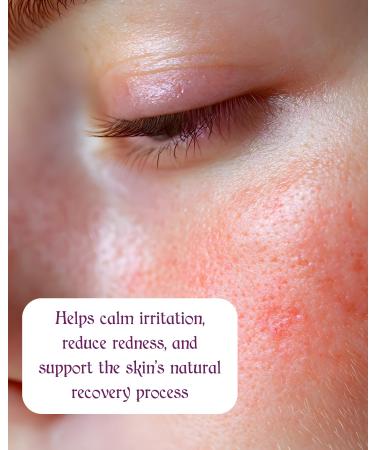 Hygia's Blue Purifying and Soothing Hypochlorous Acid Spray Fragrance-Free For Normal Dry Combination Oily Sensitive Skin Helps Calm Refresh and Protect - Buy Online on GoSupps.com