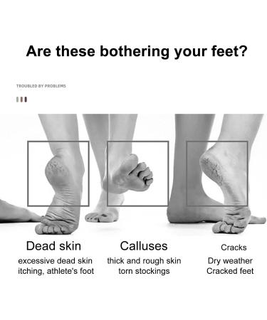 Callus Remover Feet Scrubber Exfoliation Foot Stone Foot Pumice Stones Dual Sided Foots Exfoliator Scrubber Ideal for Removing Calluses and Promoting Healthy Feet Random Color - Buy Online on GoSupps.com