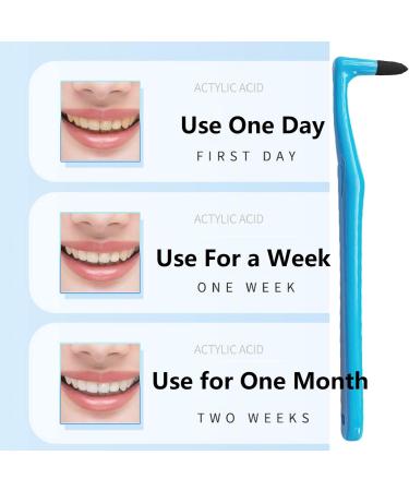 6-Piece Tartar Remover Set - Ultimate Dentist Tools for Teeth Whitening & Stain Removal - Buy Internationally - Buy Online on GoSupps.com