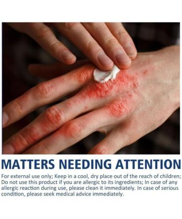 EXQST Anti-Crack Moisturizing Cream Frostbite Deep Food Frostbite Ointment Cracked Heel Foot Cream Repair Hand Cream Cracks Repair Cream - Buy Online on GoSupps.com