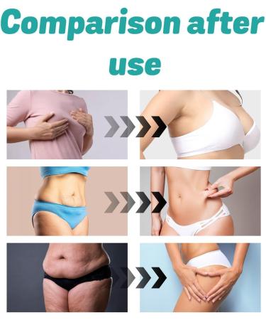 Coll-agen Fibrillar Oil Lifting Body Oil Fast Absorbing Dry Skin Moisturizer Body Oil For Women Coll-agen Body Lotion Body Treatments Oil Nourishing Hydration Oil For Neck Decollete Upper Arms - Buy Online on GoSupps.com