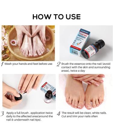 Nail Treatment Repair Toe Nail Repair Treatment Extra Strength Toenail Repair Solution Nail Renewal Liquid For Discoloration Nail & Toenails(10ML) - Buy Online on GoSupps.com