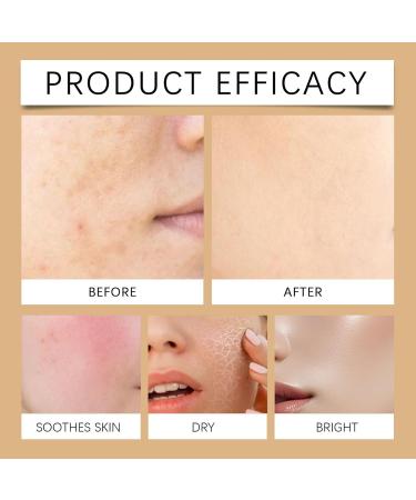  YNPQTDS Skin Brightening Treatment - 30ml Brightening Moisturizing Face Cream Firming and Repairing Face Solution - for Women Girls Wives Travel Day & Night - Buy Online on GoSupps.com