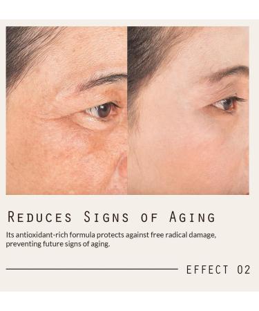 Buy ZOE Stem Cell Serum + EGF - Revitalize Skin | International Shipping Available - Buy Online on GoSupps.com