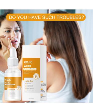 Kojic Acid Turmeric Oil Turmeric Oil Dark Spot Corrector Turmeric Face Serum Turmeric Dark Spot Corrector Serum Oil Turmeric Skin Brightening Oil Dark Spot Remover for Face Anti Aging Face Serum 100ml - Buy Online on GoSupps.com