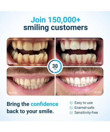 ySweetSmile Teeth Whitening Strips - 28 Mint Flavour Strips for White Teeth - Pap-Based Formula, No Peroxide, 30-Minute Application, No Pain & Sensitivity - Buy Online on GoSupps.com