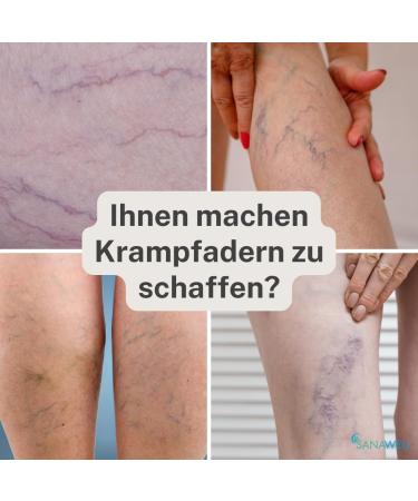MEDOSAN Venen-Ex Roll-On for Varicose Veins | 75ml | Easy & Clean Application - Shop Internationally - Buy Online on GoSupps.com