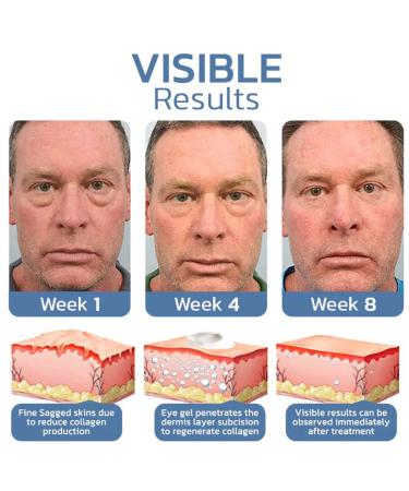 Open Eyes Peptide Gel Set - Awaken Lifting & Firming Eye Gel for Women/Men - Buy Online on GoSupps.com