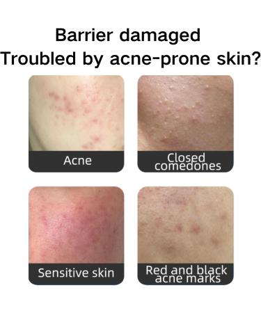 Spot Treatment - Acne Treatment - Face Serum for Women - Tea Tree Oil Serum Face - Dark Spot Correcting Glow Serum Remover for Face - Hydrating Face Serum - Fade Acne Mark 60ml - Buy Online on GoSupps.com